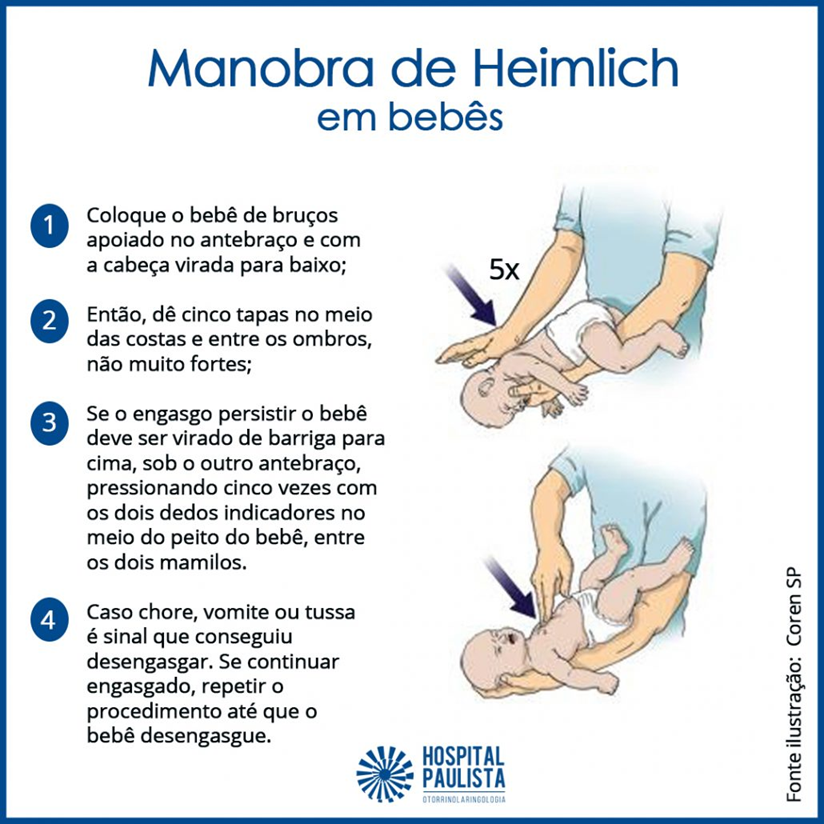Diferença entre GAG e engasgo: bebê em manobra de desobstrução com tapas nas costas e compressões torácicas