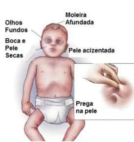 Desidratação infantil: criança tomando líquidos com orientação pediátrica